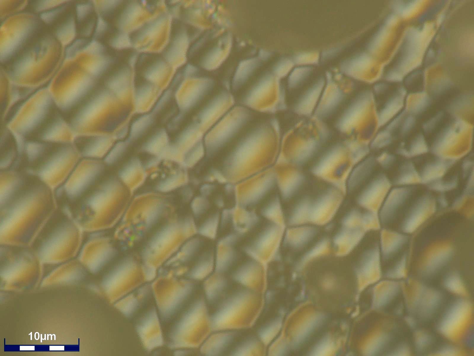 Alumina Ceramic Grains Under DIC